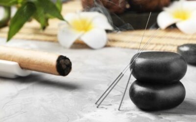 Cos’è l’agopuntura, quali effetti ha e cosa può curare